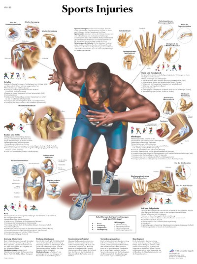 All Products - Wandkaart: Sport Injuries